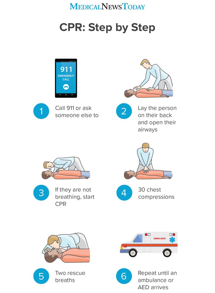 CPR with visual steps